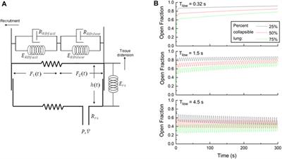 Ratchet recruitment in the acute respiratory distress syndrome: lessons from the newborn cry